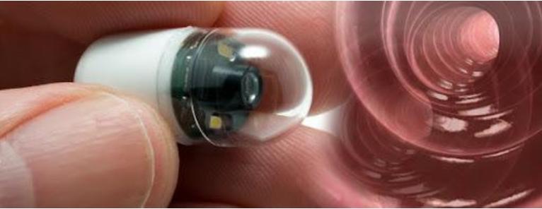 Κάψουλα λεπτού εντέρου